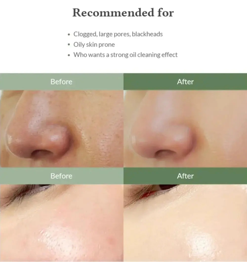 PREMIUM QUICK STEP SEBUM CLEANSER